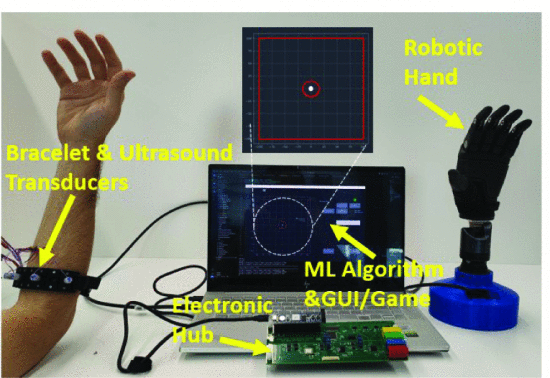 Wearable ultrasound gesture recognition demo animation